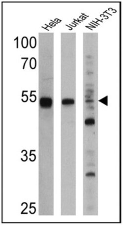 PPAR alpha/NR1C1 Antibody (3B6/PPAR) - BSA Free, Novus Biologicals 100