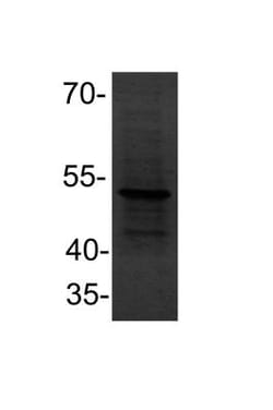 PPAR alpha/NR1C1 Antibody (OTI1E8), Novus Biologicals 0.1mL; Unlabeled:Antibodies,