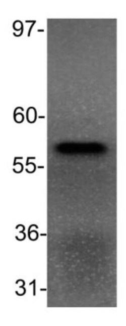 PPAR alpha/NR1C1 Antibody (3B6/PPAR) - BSA Free, Novus Biologicals 100