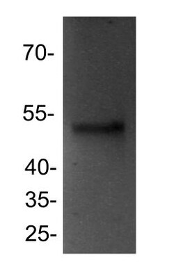 PPAR delta/NR1C2 Antibody, Novus Biologicals 0.1 mg | Buy Online | Novus Biologicals | Fisher Scientific