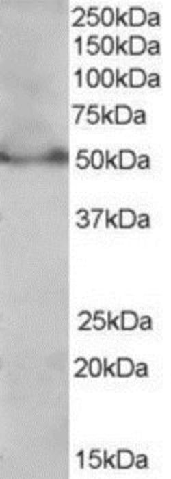 PPAR delta/NR1C2 Antibody, Novus Biologicals 0.1 mg | Buy Online | Novus Biologicals | Fisher Scientific