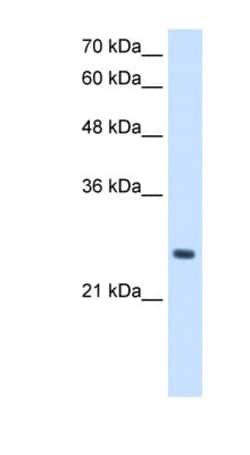 PPCDC Antibody, Novus Biologicals:Antibodies:Primary Antibodies