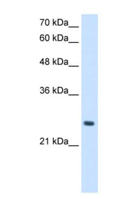 PPCDC Antibody, Novus Biologicals 100&mu;L; Unlabeled:Antibodies, Polyclonal