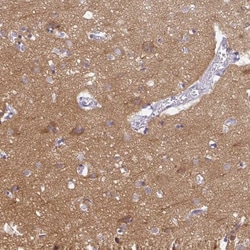 PPFIA4 Antibody, Novus Biologicals:Antibodies:Primary Antibodies