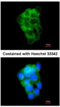 PPFIBP2 Antibody, Novus Biologicals 0.1mL; Unlabeled:Antibodies, Polyclonal