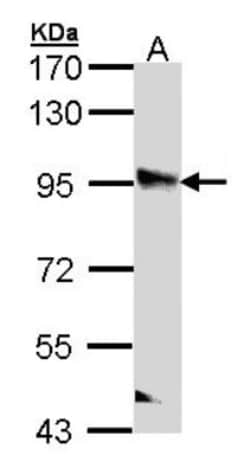 PPFIBP2 Antibody, Novus Biologicals 0.1mL; Unlabeled:Antibodies, Polyclonal