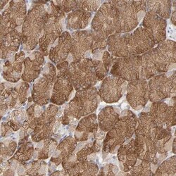 PPFIBP2 Antibody, Novus Biologicals 25 &mu;L; Unlabeled:Antibodies, Polyclonal