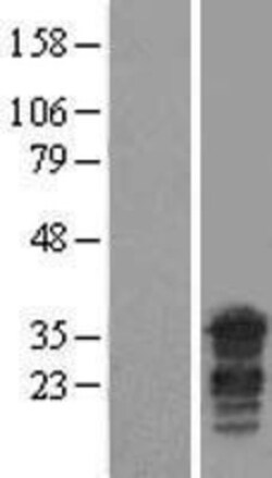 Novus Biologicals&trade;&nbsp;PPHLN1 Overexpression Lysate