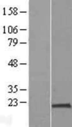 Novus Biologicals&trade;&nbsp;PPIH Overexpression Lysate