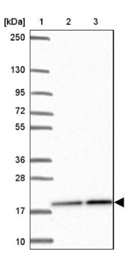 PPIH Antibody, Novus Biologicals 0.1mL; Unlabeled:Antibodies, Polyclonal