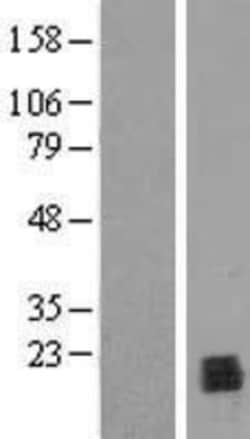Novus Biologicals&trade;&nbsp;PPIL1 Overexpression Lysate