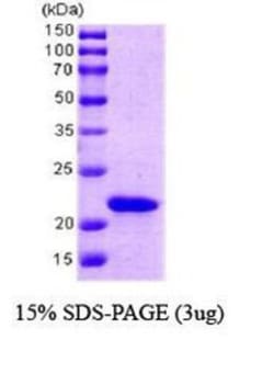 Novus Biologicals&trade;&nbsp;Recombinant E. coli PPIL1 Protein