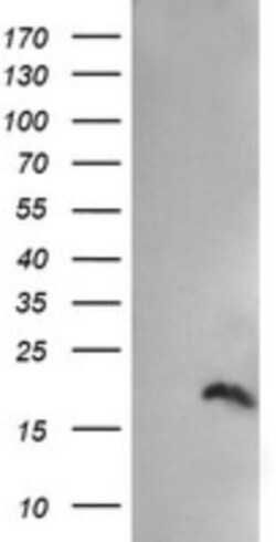PPIL3 Antibody (OTI2E7), Novus Biologicals 0.1mL; Unlabeled:Antibodies,