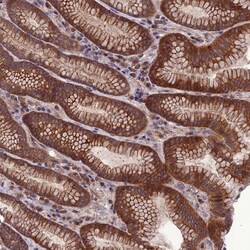 PPIL3 Antibody, Novus Biologicals:Antibodies:Primary Antibodies