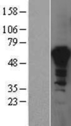 Novus Biologicals&trade;&nbsp;PPIL4 Overexpression Lysate