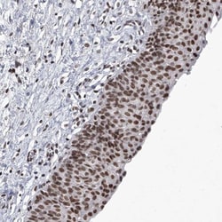 PPIL4 Antibody, Novus Biologicals 0.1mL; Unlabeled:Antibodies, Polyclonal