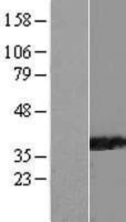Novus Biologicals™ PPIL6 Overexpression Lysate