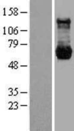 Novus Biologicals&trade;&nbsp;PP2C gamma/PPM1G Overexpression Lysate