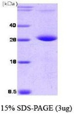 Novus Biologicals Recombinant Human PP2C gamma/PPM1G His Protein 0.1mg; Unlabeled | Buy Online | Novus Biologicals&trade; | Fisher Scientific