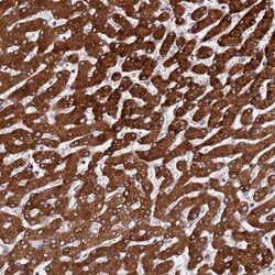PPM1H Antibody, Novus Biologicals 25 &mu;L, Unlabeled:Antibodies, Polyclonal