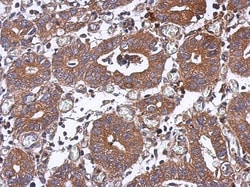 PPM1J Antibody, Novus Biologicals 0.1mL; Unlabeled:Antibodies, Polyclonal