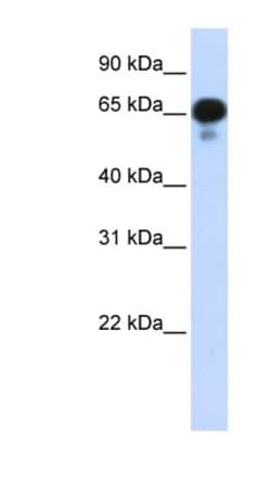 PPM1J Antibody, Novus Biologicals 100 &mu;L | Buy Online | Novus Biologicals | Fisher Scientific