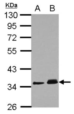 PPM1J Antibody, Novus Biologicals 0.1mL; Unlabeled:Antibodies, Polyclonal