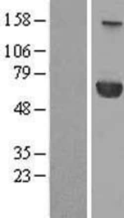 Novus Biologicals™ PPM1J Overexpression Lysate