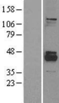Novus Biologicals&trade;&nbsp;PPM1K Overexpression Lysate