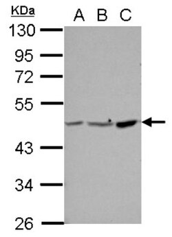 PPME1 Antibody, Novus Biologicals 0.1mL; Unlabeled:Antibodies, Polyclonal