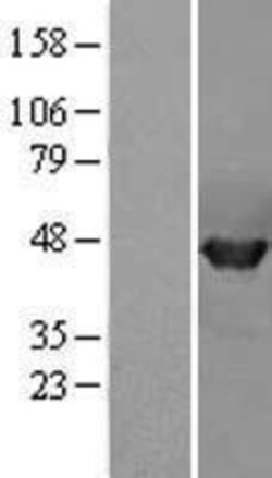 Novus Biologicals&trade;&nbsp;PPME1 Overexpression Lysate