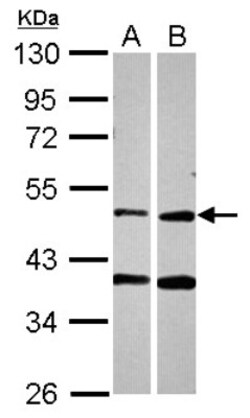 PPOX Antibody, Novus Biologicals 0.1mL; Unlabeled:Antibodies, Polyclonal