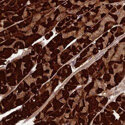 PPP1R11 Antibody, Novus Biologicals 25 &mu;L, Unlabeled:Antibodies, Polyclonal