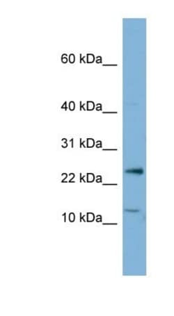 PPP1R11 Antibody, Novus Biologicals:Antibodies:Primary Antibodies