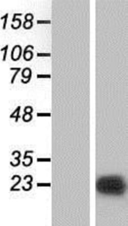 Novus Biologicals™ PPP1R14B Overexpression Lysate