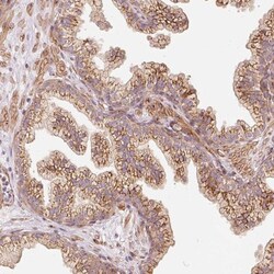 PPP1R14B Antibody, Novus Biologicals 25 &mu;L, Unlabeled:Antibodies, Polyclonal