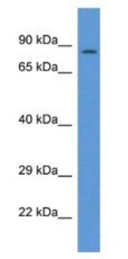 PPP1R15B Antibody, Novus Biologicals 100&mu;L; Unlabeled:Antibodies, Polyclonal