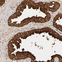 PPP1R16A Antibody, Novus Biologicals:Antibodies:Primary Antibodies