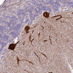 PPP1R35 Antibody, Novus Biologicals 0.1mL; Unlabeled:Antibodies, Polyclonal