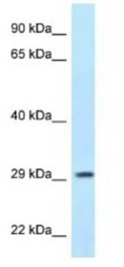 PPP1R3B Antibody, Novus Biologicals 100 &mu;L | Buy Online | Novus Biologicals | Fisher Scientific
