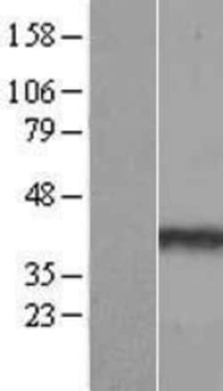 Novus Biologicals&trade;&nbsp;PPP1R3C Overexpression Lysate
