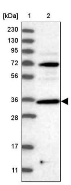 PPP1R3C Antibody, Novus Biologicals:Antibodies:Primary Antibodies