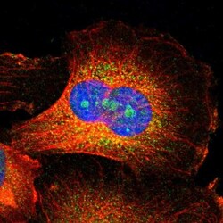 PPP1R3F Antibody, Novus Biologicals 0.1mL; Unlabeled:Antibodies, Polyclonal
