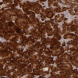 PPP1R3F Antibody, Novus Biologicals 0.1mL; Unlabeled:Antibodies, Polyclonal