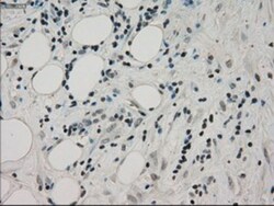 PPP1R7 Antibody (OTI4F9), Novus Biologicals 0.1mL; Unlabeled:Antibodies,