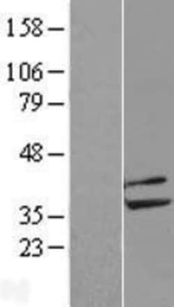 Novus Biologicals&trade;&nbsp;PPP2CB Overexpression Lysate