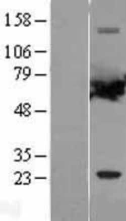Novus Biologicals&trade;&nbsp;PPP2R1A Overexpression Lysate
