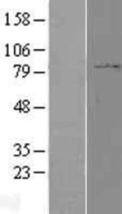 Novus Biologicals&trade;&nbsp;PPP2R1B Overexpression Lysate