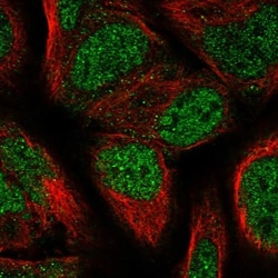PPP2R2B Antibody, Novus Biologicals 0.1mL; Unlabeled:Antibodies, Polyclonal