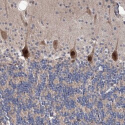 PPP2R2B Antibody, Novus Biologicals 0.1mL; Unlabeled:Antibodies, Polyclonal